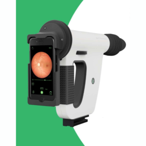Fundus-On-Phone Non Mydriatic (FOP NM) for retinal imaging