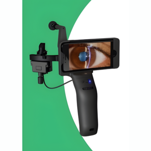 Portable Digital Slit Lamp (PSL) for Anterior Imaging