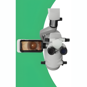 Microscope Recording Device (MRD) for Surgery Recording