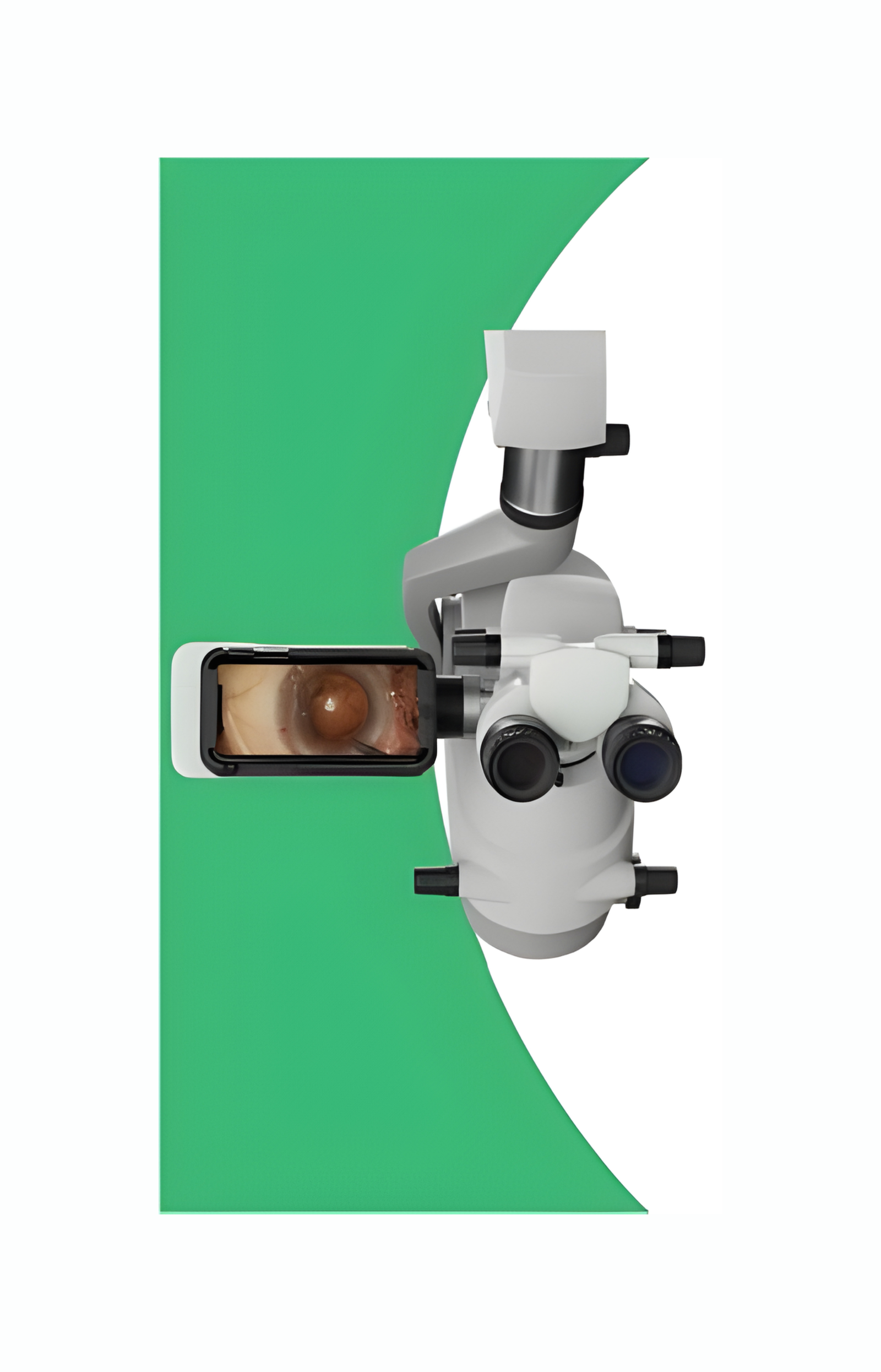 Microscope Recording Device (MRD) for Surgery Recording