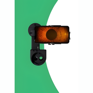 Anterior Imaging Module (AIM) for Slit Lamp Imaging